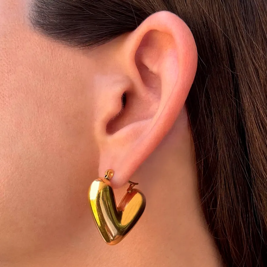 Aretes